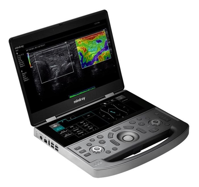 Mindray MX8 Exp